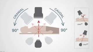 Mastering Coronary Angiography Image Intensifier amp Carm Fundamentals [upl. by Dhar]