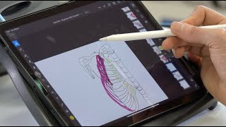 Myologie de lépaule muscles cranio cervico thoraco scapulaires [upl. by Yllrebmik590]