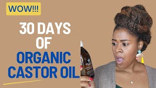 I Used CASTOR Oil for 30 Days and THIS Happened [upl. by Kerrison]