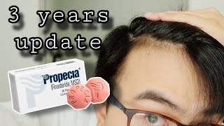 FINASTERIDE 3 years update [upl. by Hibbitts272]