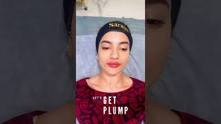 Plump Your Pout  Lip Fillers  Sarayu Clinics filler [upl. by Lietman984]