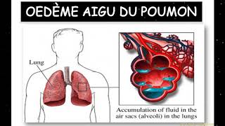 Cours pathologie médicale partie 3 [upl. by Maud]