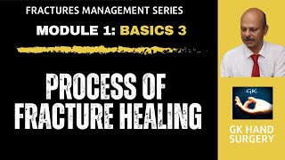 Hand fractures Basics 3  Processes of fracture healing  Direct and indirect healing phases [upl. by Llevra]