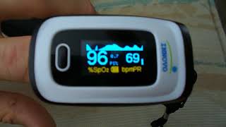 Pulse Oximeter with Atrial Fibrillation Display [upl. by Animas]