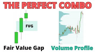 Fair Value Gap  Volume Profile The Perfect Combo for Smart Money Trading [upl. by Rovit]