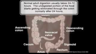 MUSC DIGESTIVE DISEASE CENTER Colonic Inertia [upl. by Yesiad]