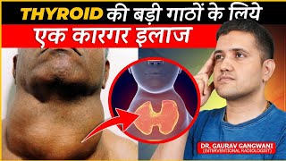 Effective Treatment For Multinodular Goitre  Thyroid Artery Embolisation  Dr Gaurav GangwaniIR [upl. by Acey591]