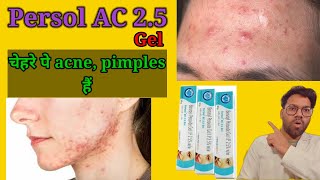 Persol AC 25 gel  acne pimples के लिए बेस्ट जेल [upl. by Daley917]