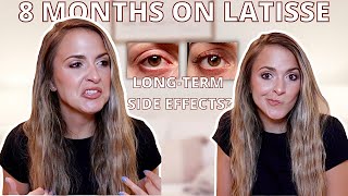 8 MONTH LATISSE RESULTS how to maintain results amp conserve product any long lasting side effects [upl. by Ahsenrad253]