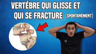 TRAITEMENT DU SPONDYLOLISTHÉSIS LOMBAIRE  EXERCICE KINÉ [upl. by Hui]