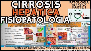 CIRROSIS HEPÁTICA FISIOPATOLOGÍA  GuiaMed [upl. by Gentille]