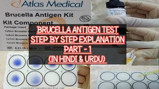 Brucella Antigen test Procedure amp Practical explained step by stepBrucellosisBrucella A amp M Specie [upl. by Bisset201]