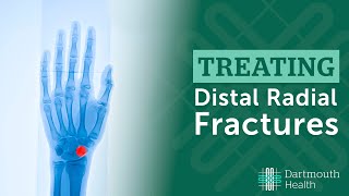 Treating Distal Radius Fractures at Dartmouth Health [upl. by Neelcaj]