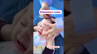 Comment the procedure name  medical procedures  IV injection  blood sample  intubationprocedure [upl. by Camp]