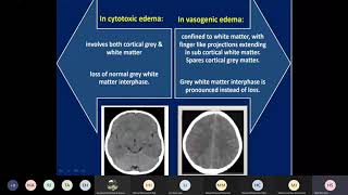 increased intracranial pressure [upl. by Araik]