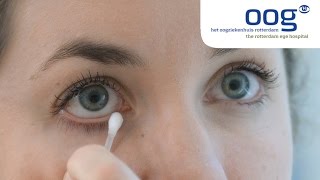 Reinigen en masseren van het ooglid bij blepharitis [upl. by Ainatnas]