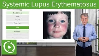 Systemic Lupus Erythematosus SLE in Children – Pediatrics  Lecturio [upl. by Rimma793]