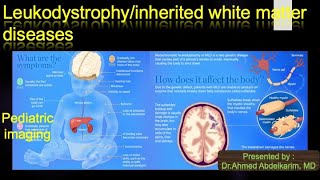 1inherited white matter disorders leukodystrophy [upl. by Gnut]