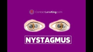 Nystagmus Eyes Explained  Involuntary Repetitive Eye Movement [upl. by Soma]