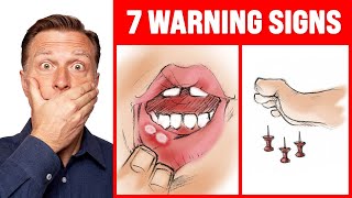 The 7 WARNING Signs of a B12 Deficiency  Dr Berg [upl. by Rutledge]