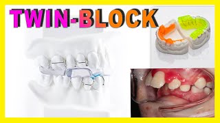 ♦️TWIN BLOCK♦️ Aparato dental para NIÑOS para corregir HIPOPLASIA MANDIBULAR [upl. by Feodore]