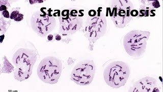 Stages of Meiosis [upl. by Ahsima]