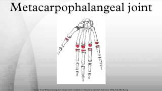 Metacarpophalangeal joint [upl. by Phira]