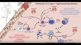 Type I Hypersensitivity  Mechanism Described Concisely [upl. by Eelarat]