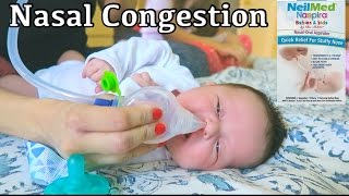 NASAL CONGESTION NEWBORNS [upl. by Nairadal]