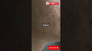 3 STRANGE Bacteria Living Inside You Right Now 🦠 shorts bacteria facts science education [upl. by Opiuuk205]