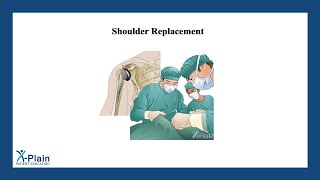 Shoulder Replacement [upl. by Alemahs30]