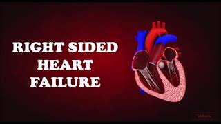 RIGHT SIDED HEART FAILURE CAUSES SYMPTOMS MORPHOLOGY [upl. by Nadeau916]