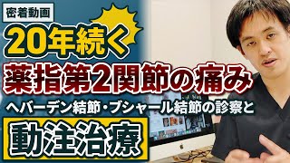 診察風景 密着動画 20年以上続く指の痛み（くすり指第2関節）へバーデン結節・ブシャール結節の診察風景と動注治療 [upl. by Aivartal]