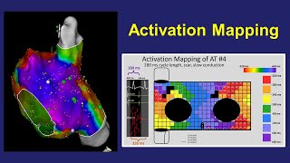 Activation Mapping Basic Concepts Pitfalls and Windowing [upl. by Millhon]