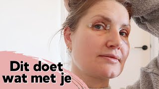 MIJN OOGLIDCORRECTIE EN WE KOMEN WEER TOT LEVEN  VLOG 669  Diesna Loomans [upl. by Mukerji618]