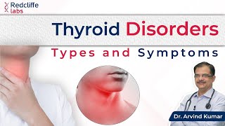 What are Thyroid Disorders जानें Thyroid के लक्षण कारण और इलाज के बारे में  Dr Arvind Kumar [upl. by Nairot]