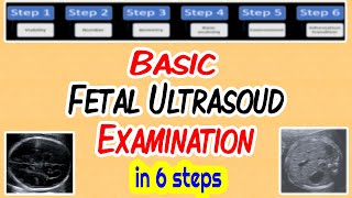 Basic Fetal Ultrasound Examination [upl. by Etnor]