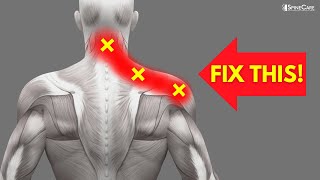 How to INSTANTLY Fix Pinched Nerve Pain in the Neck and Shoulders [upl. by Anawad429]