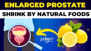 Prostate Enlargement Treat Naturally  Benign Prostatic Hyperplasia [upl. by Ynobe810]