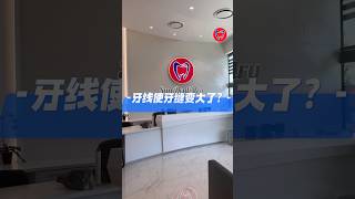 温哥华牙医 dentistry vancouver 阳光牙科 使用牙线会使牙缝变大吗💡 [upl. by Odlabso610]