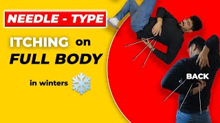 Winter skin Problems  Winters Body Care Routine  Itching in Winters  Dry Skin  Sahil Gera [upl. by Ydnerb851]