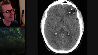 Isolation tutorial Neuroradiology 2 with Frank Gaillard [upl. by Nomyad]