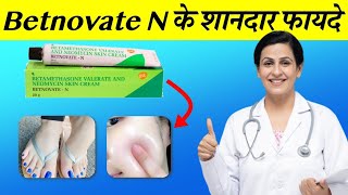 Betnovate N cream  Betamethasone Neomycincream betnovate n skin cream [upl. by Oliy366]