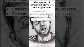 Management of generalized convulsive status epilepticus [upl. by O'Malley]