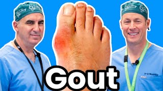 Do You Have Gout Heres How To Diagnose Treat and Prevent It [upl. by Kendal194]