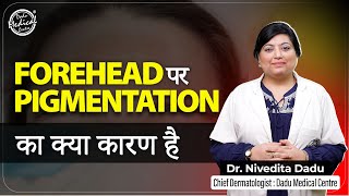 क्या आपके Forehead Pigmentation का कारण क्या बन रहा है  Forehead Pigmentation Treatment  DMC [upl. by Lainahtan]