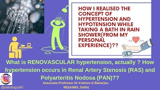 Hypertension Vs Hypotension SimplifiedWhy we get hypertension in Renal artery stenosis amp PAN md [upl. by Aneahs225]