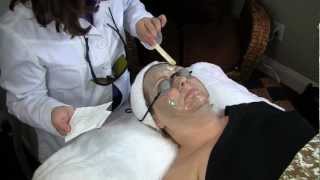 IPL Intense Pulsed Light Facial Laser Treatment [upl. by Jesselyn37]