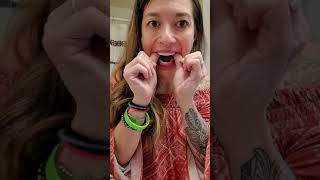 Most HONEST Review of Pop On Veneers You must watch this if youre thinking of getting veneers [upl. by Carlene]