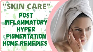 Post Inflammatory Hyperpigmentation Home Remedies  Skin Care [upl. by Kammerer412]